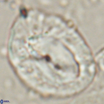 Helicosphaerella compacta VR 027545