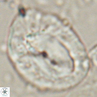 Helicosphaerella compacta VR 027545