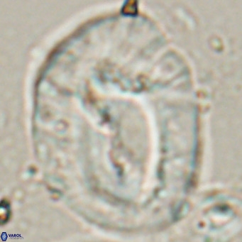 Helicosphaerella compacta VR 027546
