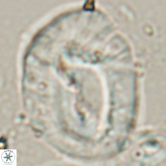 Helicosphaerella compacta VR 027546