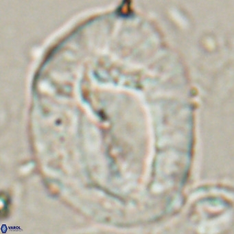 Helicosphaerella compacta VR 027547