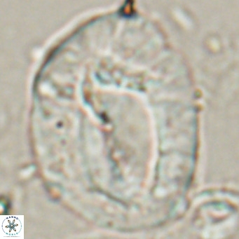 Helicosphaerella compacta VR 027547