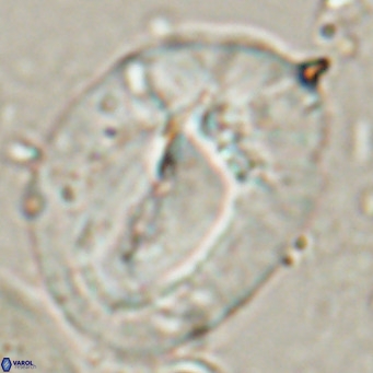 Helicosphaerella compacta VR 027548