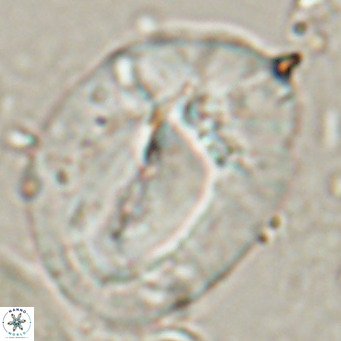 Helicosphaerella compacta VR 027548