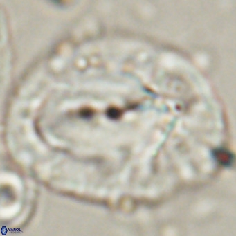 Helicosphaerella compacta VR 027549