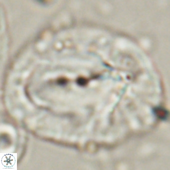 Helicosphaerella compacta VR 027549