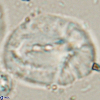 Helicosphaerella compacta VR 027550