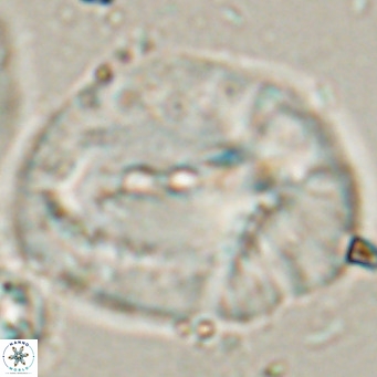 Helicosphaerella compacta VR 027550