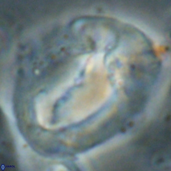 Helicosphaerella compacta VR 027552