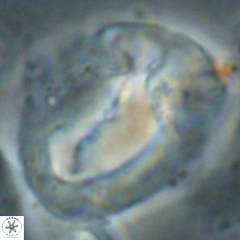 Helicosphaerella compacta VR 027552