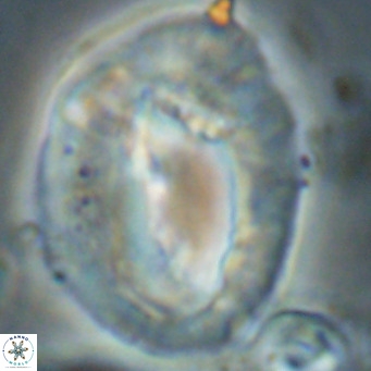 Helicosphaerella compacta VR 027553