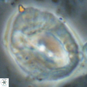 Helicosphaerella compacta VR 027554