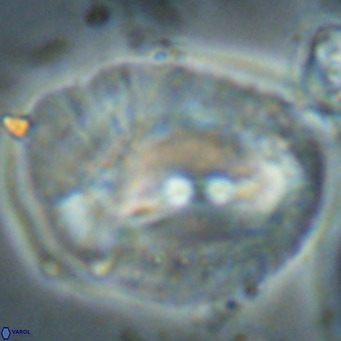 Helicosphaerella compacta VR 027555