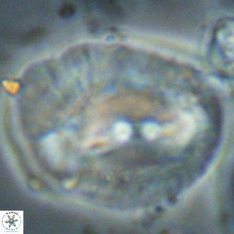 Helicosphaerella compacta VR 027555