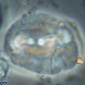 Helicosphaerella compacta VR 027556