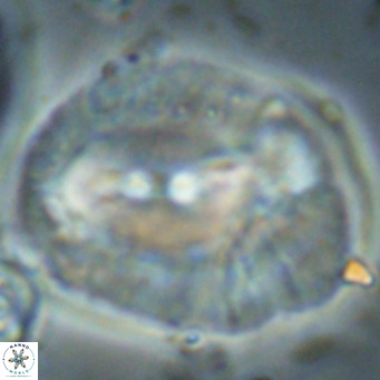 Helicosphaerella compacta VR 027556
