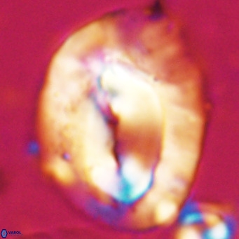 Helicosphaerella compacta VR 027533