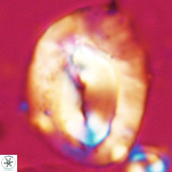 Helicosphaerella compacta VR 027533