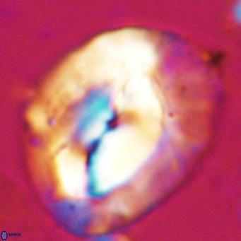Helicosphaerella compacta VR 027534