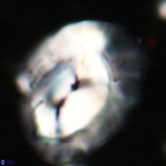 Helicosphaerella compacta VR 027535