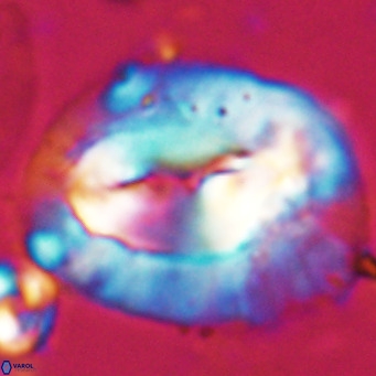 Helicosphaerella compacta VR 027537