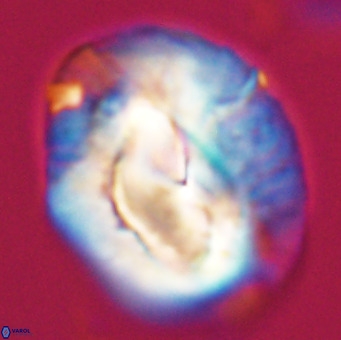 Helicosphaerella compacta VR 32684
