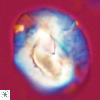 Helicosphaerella compacta VR 32684