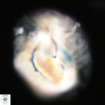 Helicosphaerella compacta VR 32685