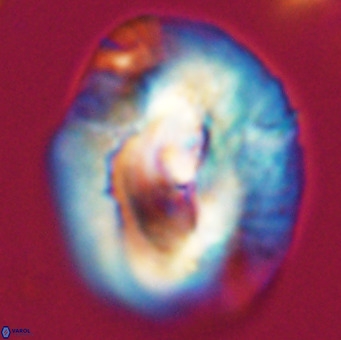 Helicosphaerella compacta VR 32686