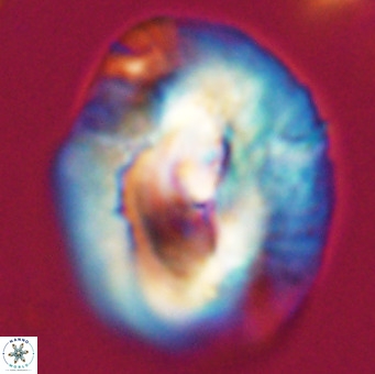 Helicosphaerella compacta VR 32686