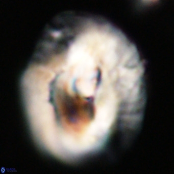 Helicosphaerella compacta VR 32687