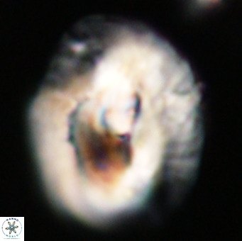 Helicosphaerella compacta VR 32687