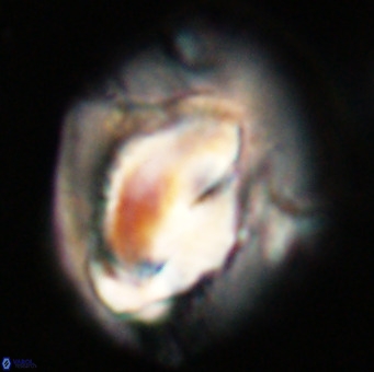 Helicosphaerella compacta VR 32688