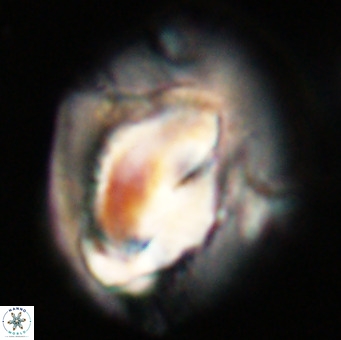 Helicosphaerella compacta VR 32688