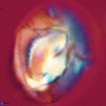 Helicosphaerella compacta VR 32689