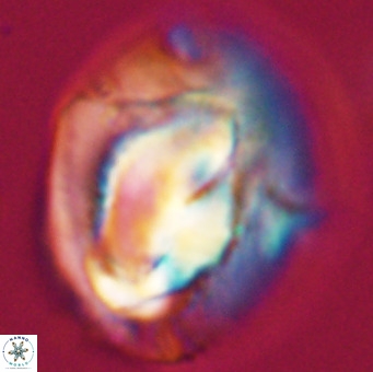 Helicosphaerella compacta VR 32689