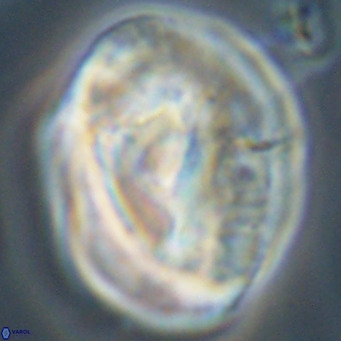 Helicosphaerella compacta VR 32694