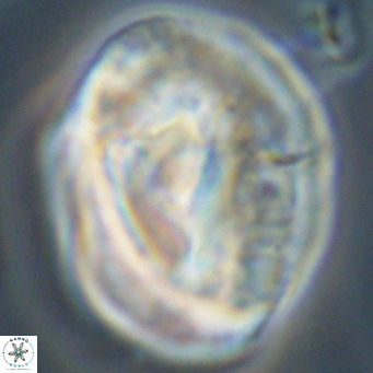 Helicosphaerella compacta VR 32694