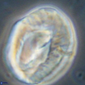 Helicosphaerella compacta VR 32695