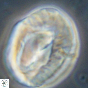 Helicosphaerella compacta VR 32695