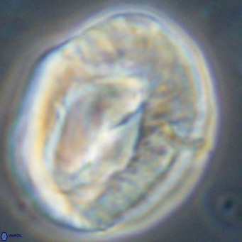 Helicosphaerella compacta VR 32696