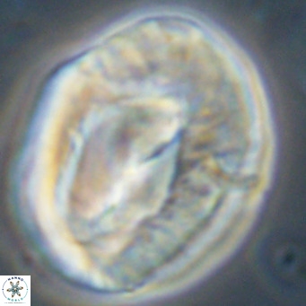 Helicosphaerella compacta VR 32696