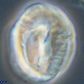 Helicosphaerella compacta VR 32697