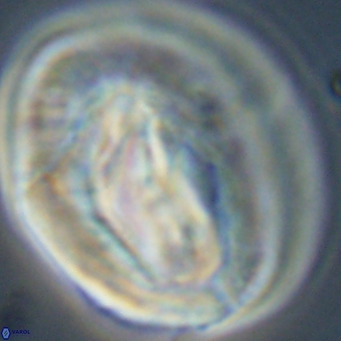 Helicosphaerella compacta VR 32698