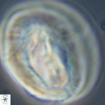 Helicosphaerella compacta VR 32698