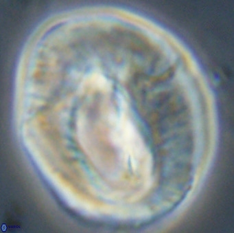 Helicosphaerella compacta VR 32699