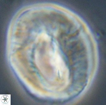 Helicosphaerella compacta VR 32699