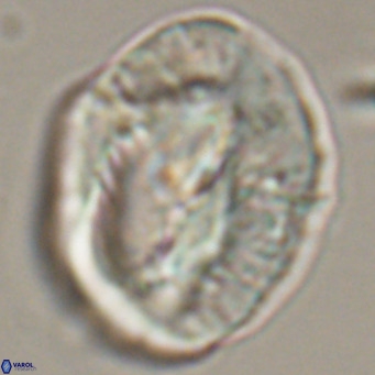 Helicosphaerella compacta VR 32690