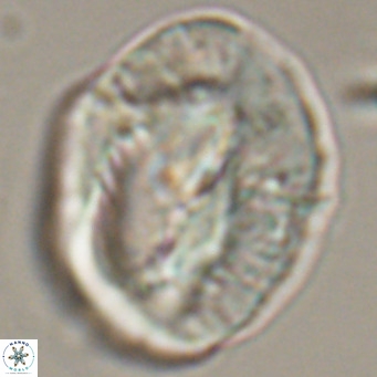 Helicosphaerella compacta VR 32690