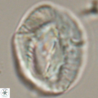 Helicosphaerella compacta VR 32691